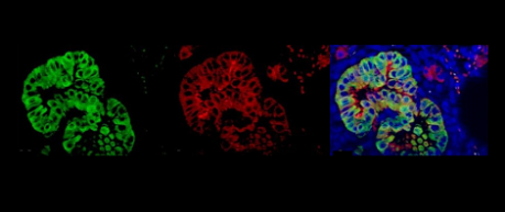 lung images - credit University of Edinburgh