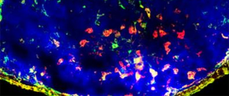 Immune cells - credit Roslin Innovation Centre